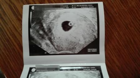 Bild zu Etwas verunsichert - Schwanger - wer noch? Rund um die Schwangerschaft