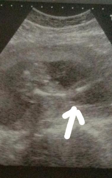 Bild zu junge? - Schwanger - wer noch? Rund um die Schwangerschaft