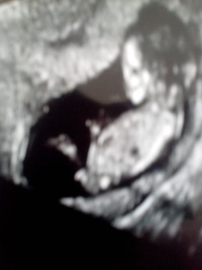 Bild zu Nub Theorie - wird mein Baby ein Junge oder Mädchen - Schwanger - wer noch? Rund um die Schwangerschaft