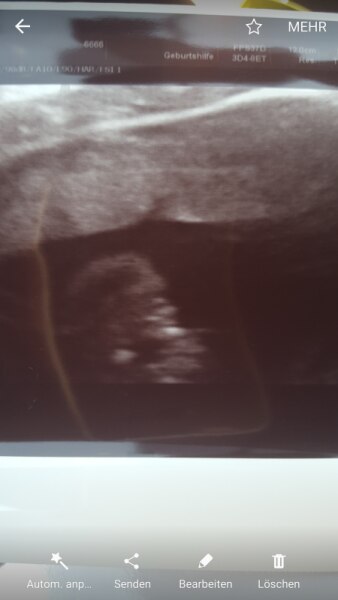 Bild zu 20+1 ssw OUTING - Schwanger - wer noch? Rund um die Schwangerschaft