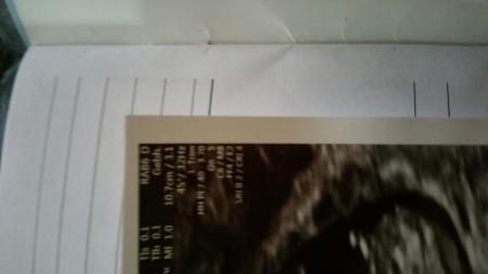 Bild zu Größe und Gewicht - Schwanger - wer noch? Rund um die Schwangerschaft