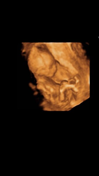 Bild zu Junge oder Mädchen? - Schwanger - wer noch? Rund um die Schwangerschaft