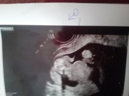 Bild zu 100% outing - Schwanger - wer noch? Rund um die Schwangerschaft