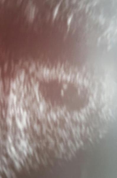 Bild zu Ssw? - Schwanger - wer noch? Rund um die Schwangerschaft