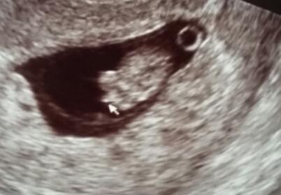 Bild zu Was denkt ihr 11+4 (junge ???) - Schwanger - wer noch? Rund um die Schwangerschaft