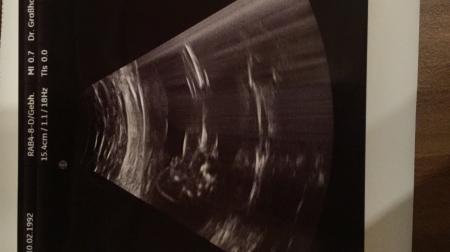 Bild zu Was meint ihr junge oder Mädchen ? - Schwanger - wer noch? Rund um die Schwangerschaft