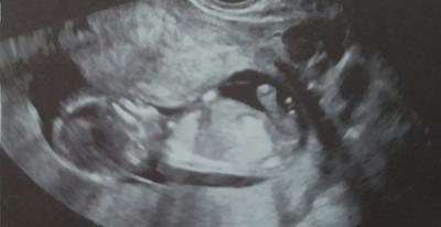 Bild zu Ein Outing?? - Schwanger - wer noch? Rund um die Schwangerschaft