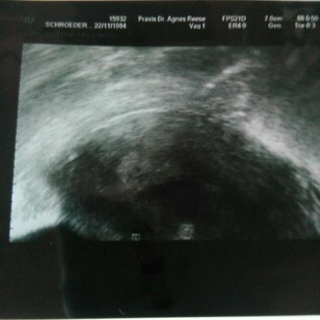 Bild zu Kann das wirklich sein??? Hilfe bitte!!! - Schwanger - wer noch? Rund um die Schwangerschaft