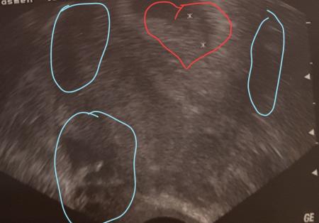 Bild zu Direkt ne frage zum Ultraschall - Schwanger - wer noch? Rund um die Schwangerschaft