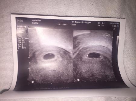 Bild zu Windei? - Schwanger - wer noch? Rund um die Schwangerschaft