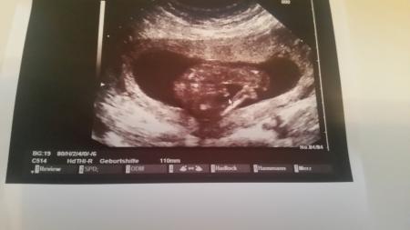 Bild zu Junge oder Mädchen? - Schwanger - wer noch? Rund um die Schwangerschaft