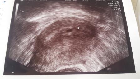 Bild zu Was seht ihr? - Schwanger - wer noch? Rund um die Schwangerschaft