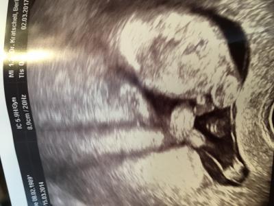 Bild zu Geschlecht bei 14+4 ssw - Schwanger - wer noch? Rund um die Schwangerschaft