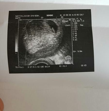 Bild zu Und man sieht den Knirps doch. :-) - Schwanger - wer noch? Rund um die Schwangerschaft