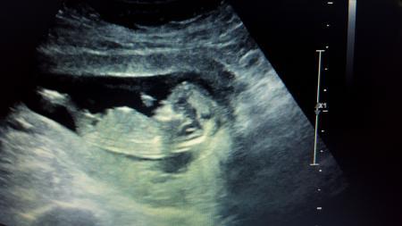 Bild zu Outing 12+6 - Schwanger - wer noch? Rund um die Schwangerschaft