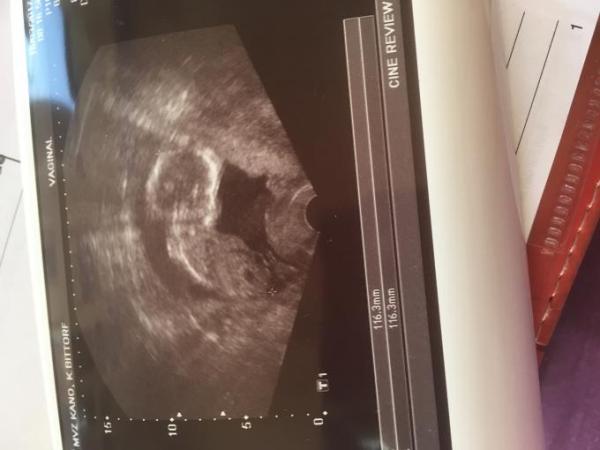 Bild zu Frage zum Geschlechter - Schwanger - wer noch? Rund um die Schwangerschaft