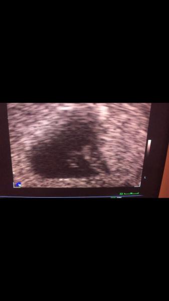 Bild zu Ultraschall - Schwanger - wer noch? Rund um die Schwangerschaft