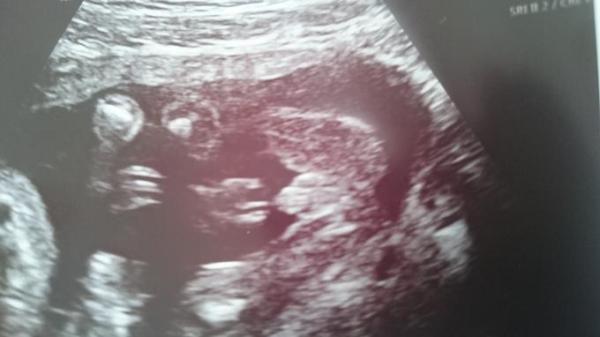 Bild zu Könnt ihr es auch erkennen? - Schwanger - wer noch? Rund um die Schwangerschaft