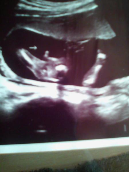 Bild zu Outing, euer Tip - Schwanger - wer noch? Rund um die Schwangerschaft