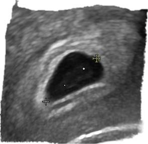 Bild zu 1.ultraschall - Schwanger - wer noch? Rund um die Schwangerschaft