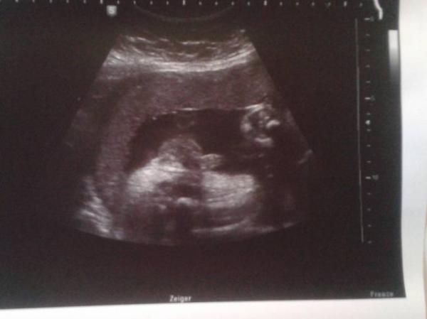 Bild zu Wer erkennt was? - Schwanger - wer noch? Rund um die Schwangerschaft