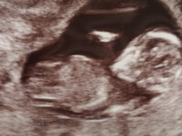 Bild zu Geschlecht erkennbar??? - Schwanger - wer noch? Rund um die Schwangerschaft