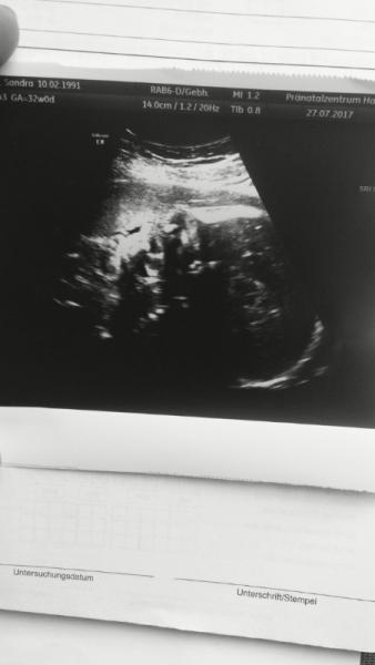 Bild zu Situation hat sich wieder verändert.. - Schwanger - wer noch? Rund um die Schwangerschaft