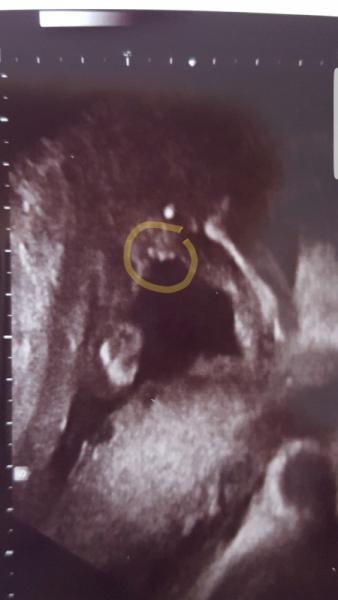 Bild zu Outing - Schwanger - wer noch? Rund um die Schwangerschaft