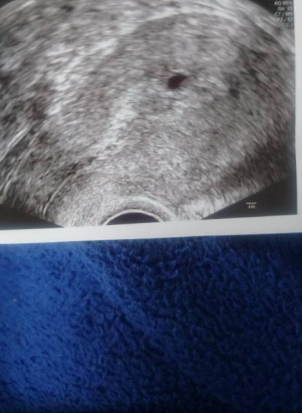 Bild zu Ich flipp aus - Schwanger - wer noch? Rund um die Schwangerschaft