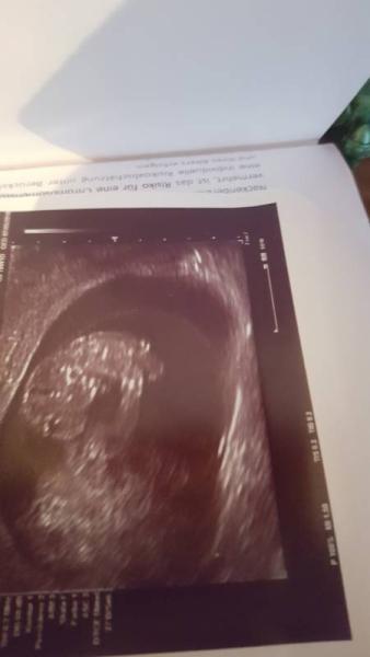 Bild zu Unser 2. Wunder kommt im Mai :) - Schwanger - wer noch? Rund um die Schwangerschaft