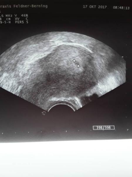 Bild zu Vorsichtige Freude - Schwanger - wer noch? Rund um die Schwangerschaft