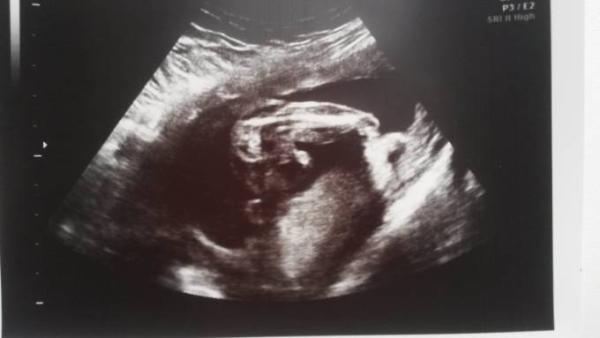 Bild zu An die Ultraschallprofis - Schwanger - wer noch? Rund um die Schwangerschaft