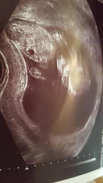 Bild zu neues Update - Schwanger - wer noch? Rund um die Schwangerschaft