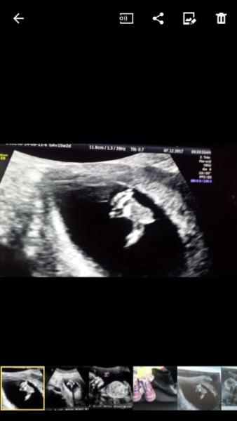 Bild zu An die Outing Experten :-) - Schwanger - wer noch? Rund um die Schwangerschaft