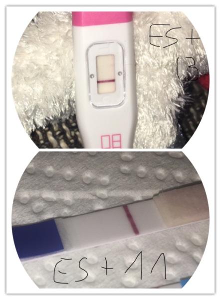 Bild zu Sst es+11 und es+13 - Schwanger - wer noch? Rund um die Schwangerschaft