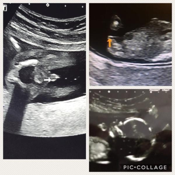 Bild zu Outing - Schwanger - wer noch? Rund um die Schwangerschaft