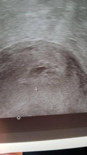 Bild zu Wer erkennt was? - Schwanger - wer noch? Rund um die Schwangerschaft