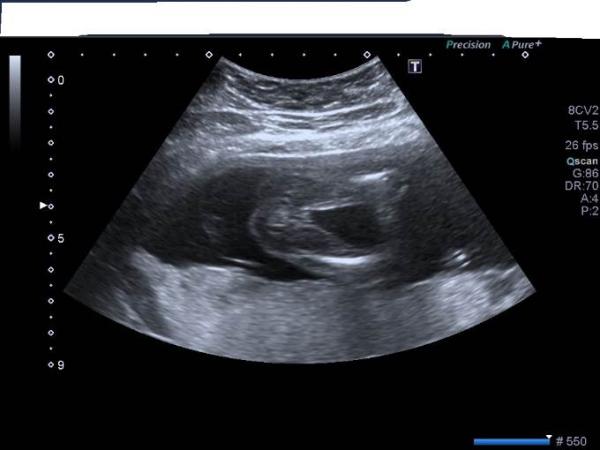 Bild zu Erkennt Ihr an dem Bild das Geschlecht? - Schwanger - wer noch? Rund um die Schwangerschaft