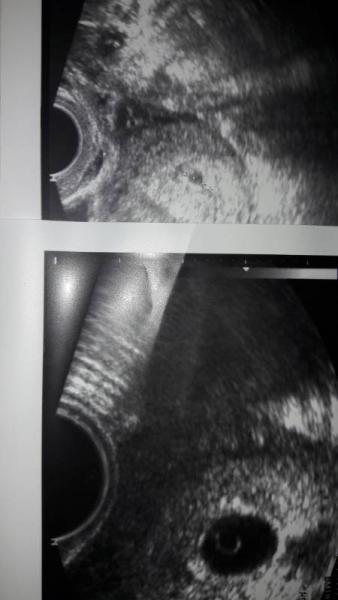 Bild zu Ist es noch möglich? - Schwanger - wer noch? Rund um die Schwangerschaft