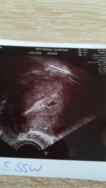 Bild zu 1. Termin - Schwanger - wer noch? Rund um die Schwangerschaft