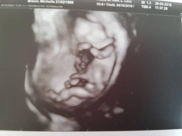 Bild zu Outing welches Team? - Schwanger - wer noch? Rund um die Schwangerschaft