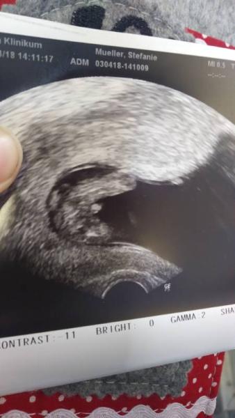 Bild zu @OliviaÖl - Schwanger - wer noch? Rund um die Schwangerschaft