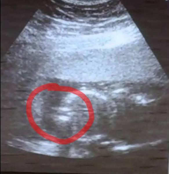 Bild zu US-Bild - - Was glaubt ihr? - Schwanger - wer noch? Rund um die Schwangerschaft