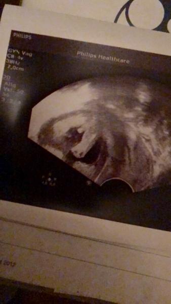 Bild zu Junge ? Oder was könnte das da sein ? - Schwanger - wer noch? Rund um die Schwangerschaft