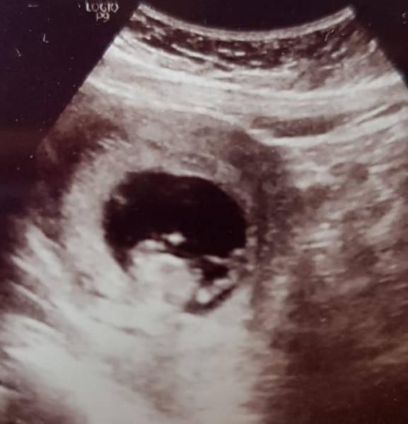 Bild zu Junge oder Mädchen? - Schwanger - wer noch? Rund um die Schwangerschaft