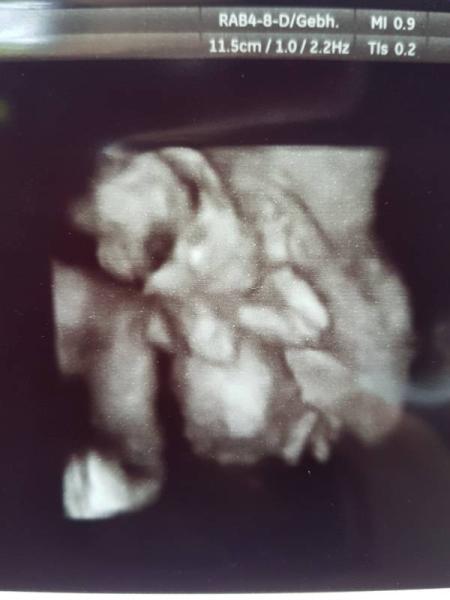 Bild zu Wieviele babys seht ihr? - Schwanger - wer noch? Rund um die Schwangerschaft