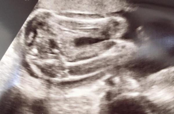 Bild zu Geschlecht sicher? - Schwanger - wer noch? Rund um die Schwangerschaft