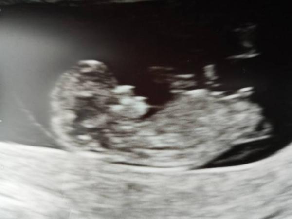 Bild zu Nub Theorie??? - Schwanger - wer noch? Rund um die Schwangerschaft
