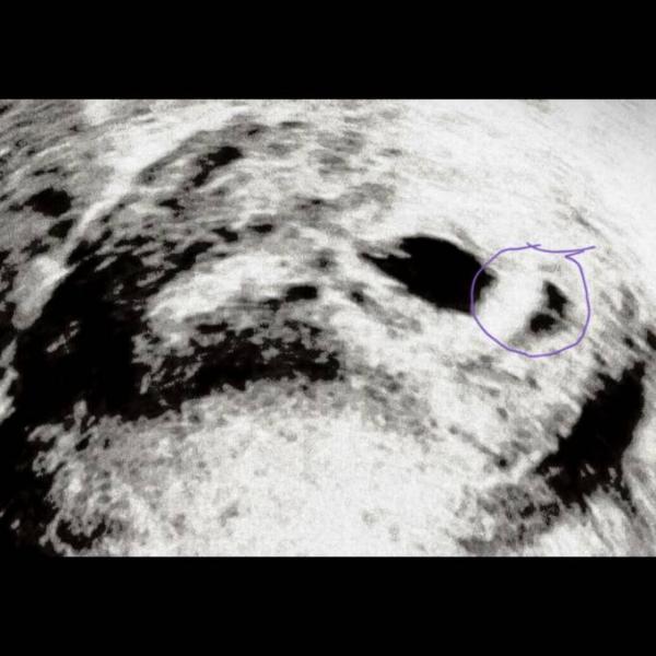 Bild zu Was ist das ? 😅 - Schwanger - wer noch? Rund um die Schwangerschaft