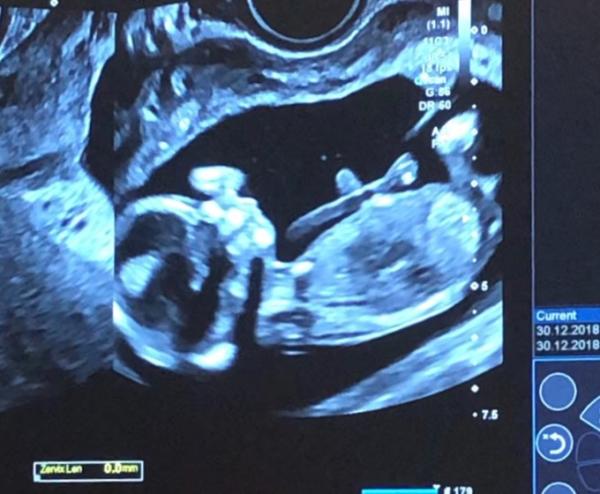 Bild zu Tendenz vorhanden - Schwanger - wer noch? Rund um die Schwangerschaft